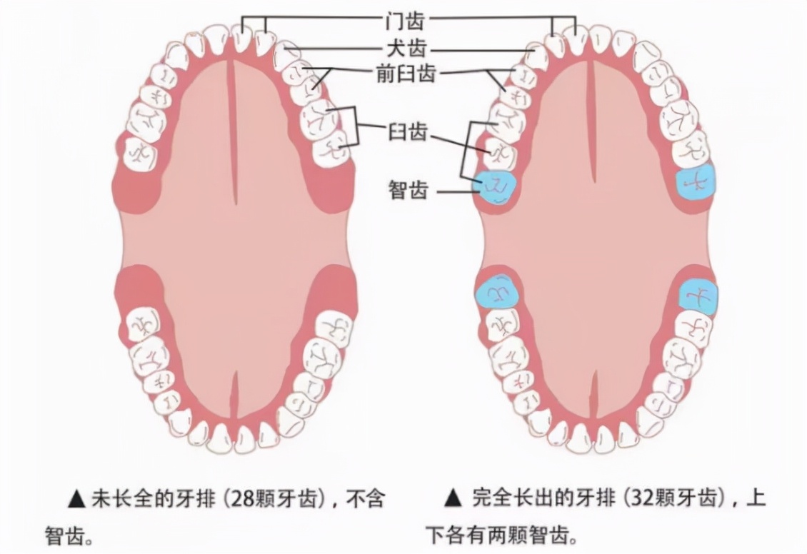 「牙齿那些事儿」No.77丨啊啊啊！智齿为什么会疼啊？该不该拔？