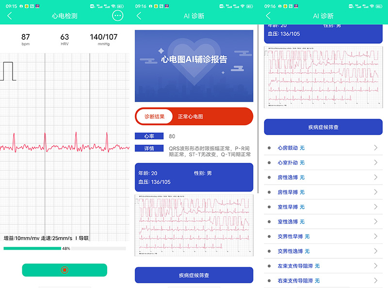 数据准、功能全才是硬道理——dido血压智能手表E10测评