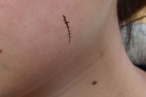 自愈力能吃出来吗？哈佛大学教授，公布最佳吃法，别人还不知道