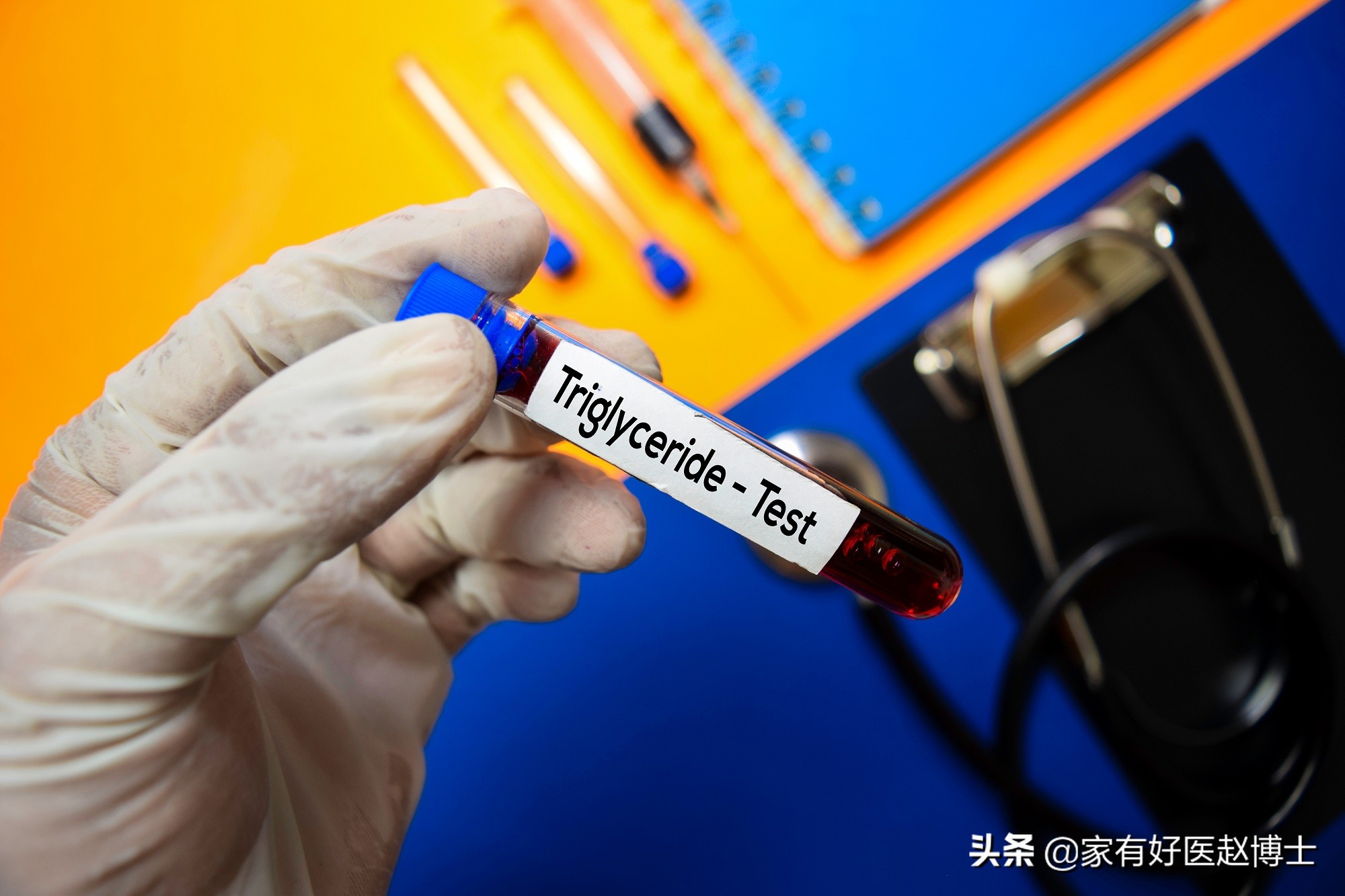 吃了他汀但甘油三酯仍高，心血管残余风险不小！如何有效控制？