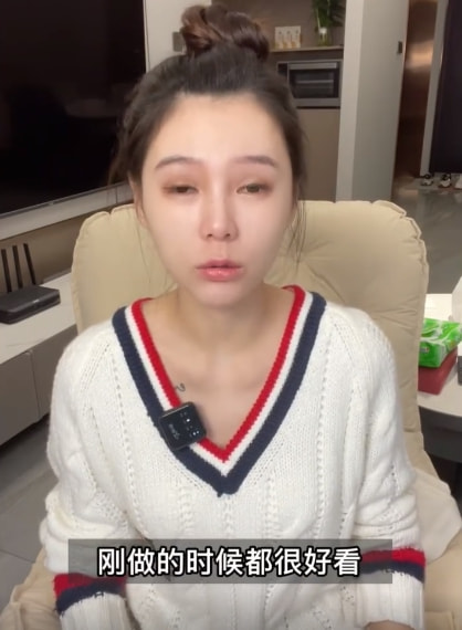 女網(wǎng)紅曬整容前后對(duì)比照，直言整容太多臉部松弛老10歲，后悔痛哭