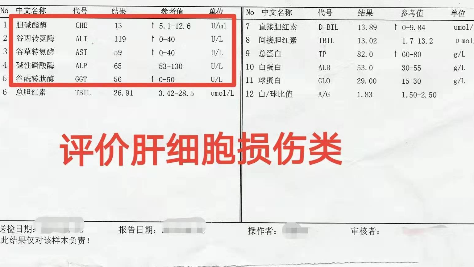 肝功能檢查單怎么看？醫生：這3個指標正常，說明你的肝臟很健康