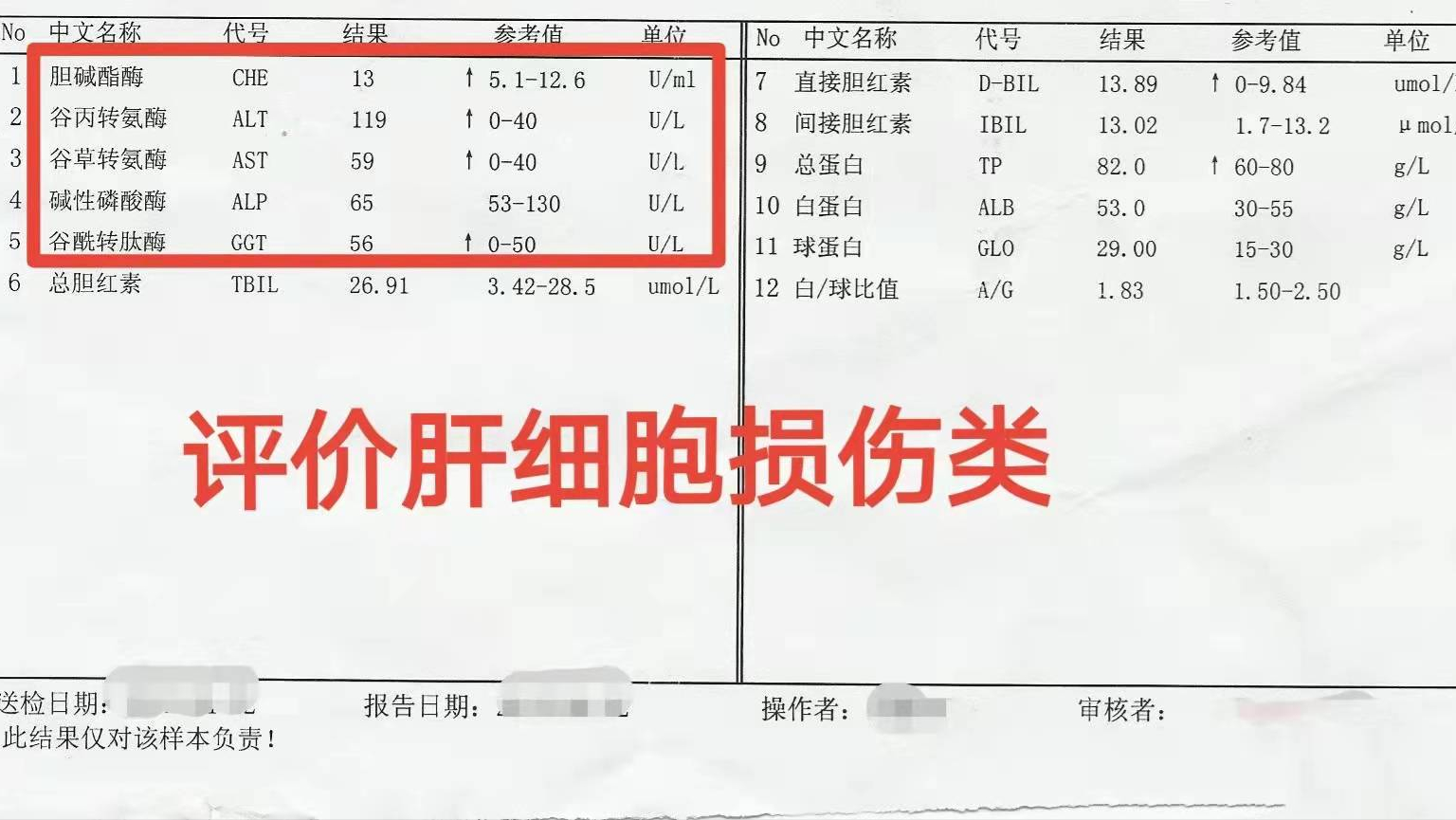 肝功能检查单怎么看？医生：这3个指标正常，说明你的肝脏很健康