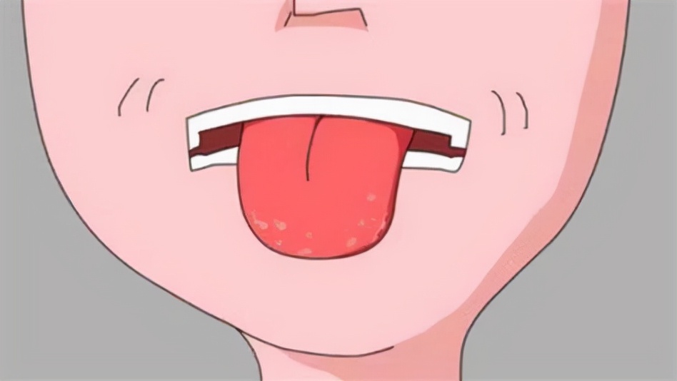 即便你这样,我们的舌头上虽然也有大动脉,但是大动脉差不多在嗓子眼处