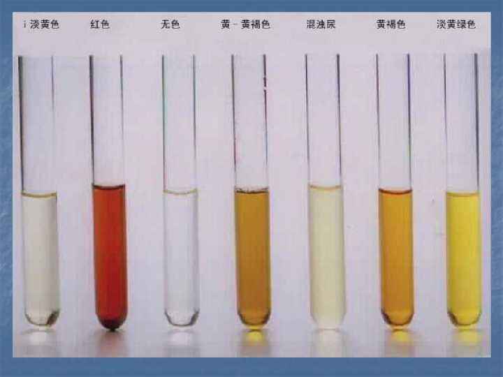 晨起后有这4种表现，说明您的身体健康状况良好，可以继续保持