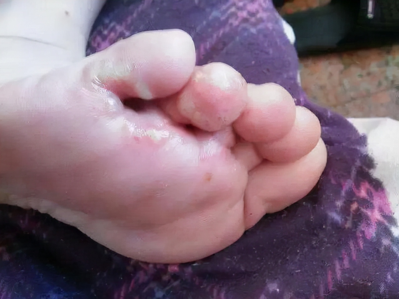 常泡腳養生？ 提醒：4類中老年人真的不適合，要注意