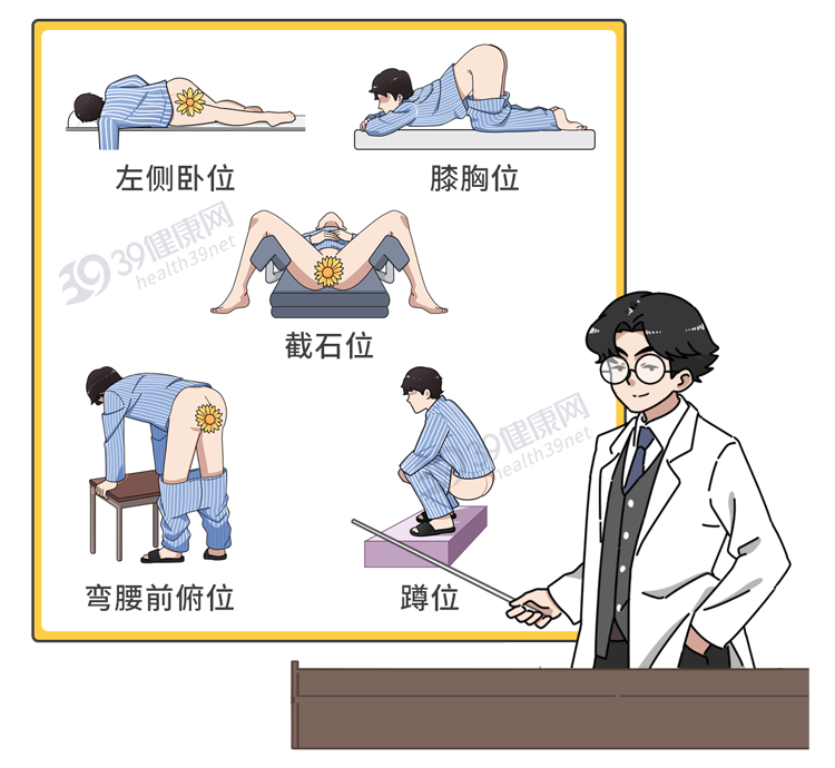 保护肛门有多重要？每天清洗肛门可以预防疾病？到底怎么回事？