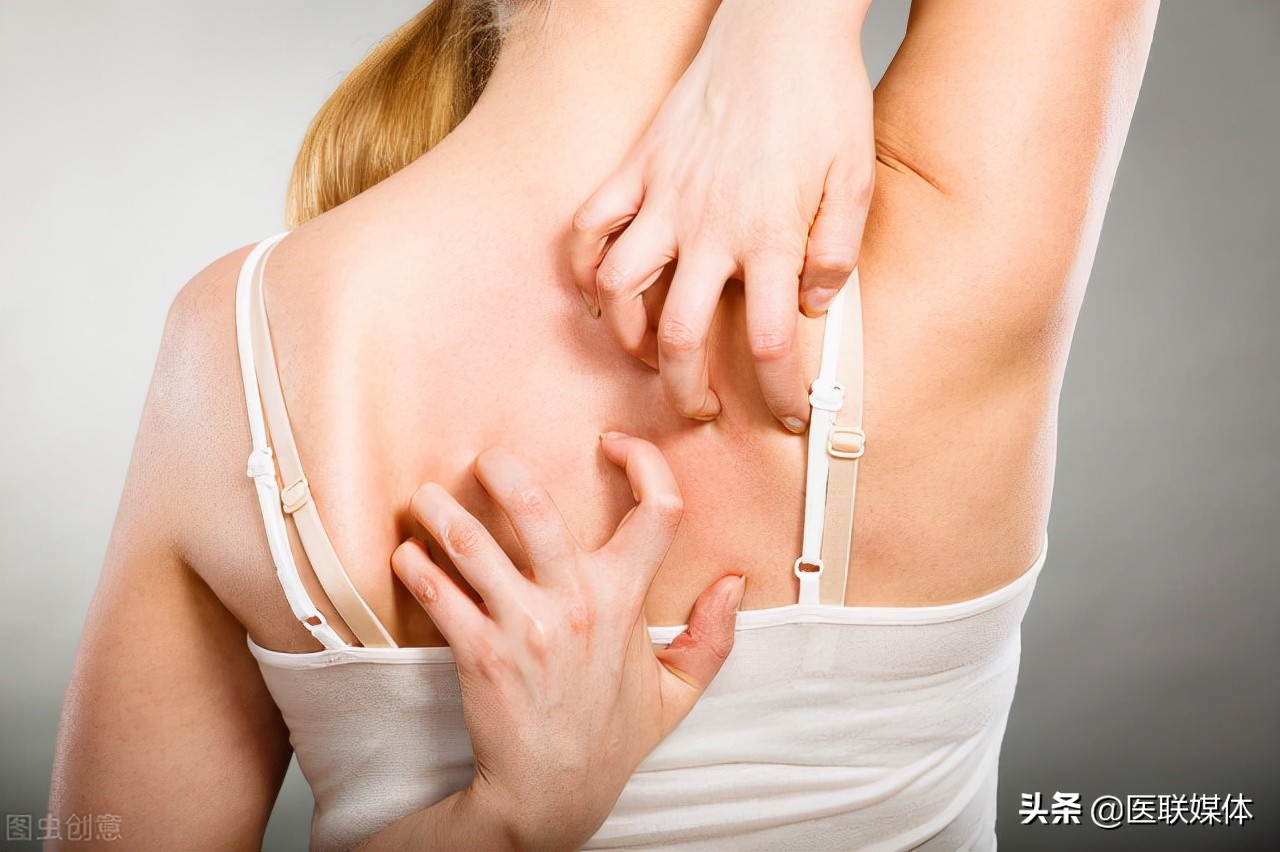 为何会突然长湿疹？多半与这4个因素有关，反思一下