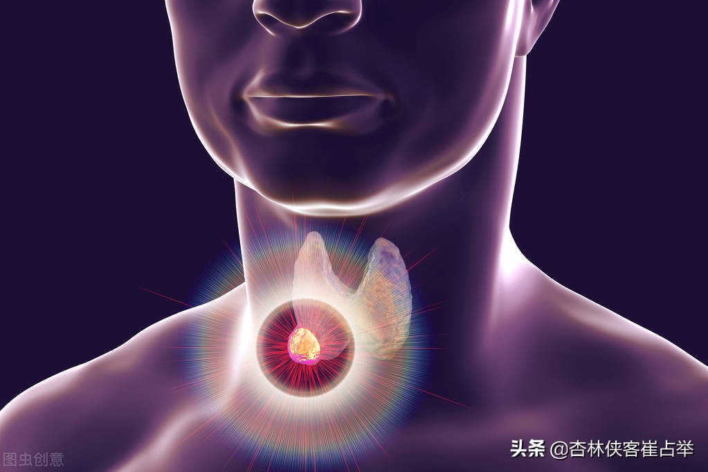 結節、囊腫？ 多因痰火鬱結，講一個中成藥，清肝瀉火，軟堅散結