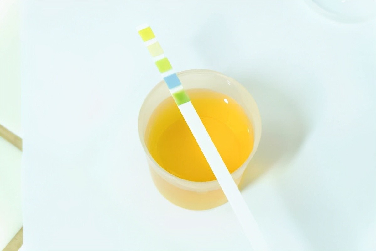 睡前小便，是正常的生理表现，但若多次起夜，应当警惕起来