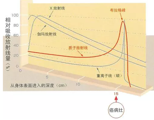 攜手中科院！華為殺入重離子治療