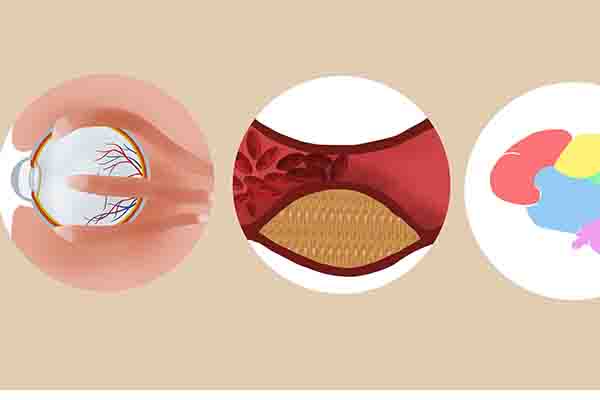 老花眼突然“自愈了”，这正常吗？别高兴得太早，或和1件事有关