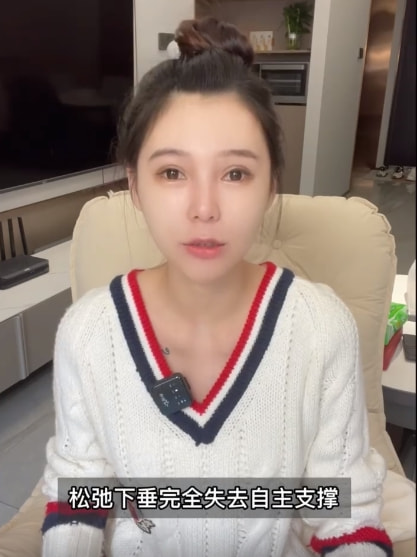 女網(wǎng)紅曬整容前后對比照，直言整容太多臉部松弛老10歲，后悔痛哭