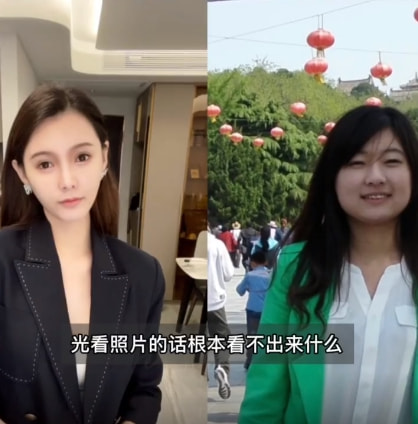 女网红晒整容前后对比照，直言整容太多脸部松弛老10岁，后悔痛哭