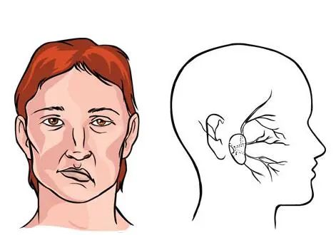面肌抽搐的临床表现有哪些？唐运林教授为你解答