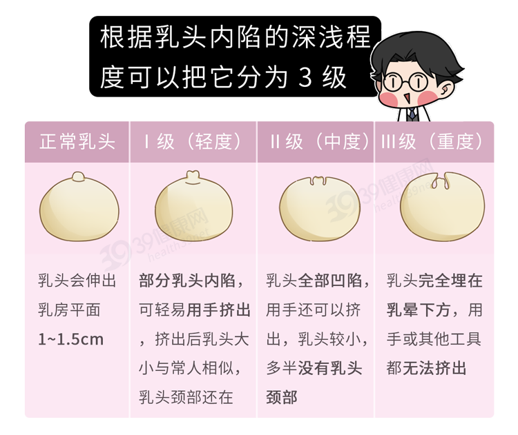 什么是“乳头内陷”？要怎么治疗？2个原因，可能让它暂时消失