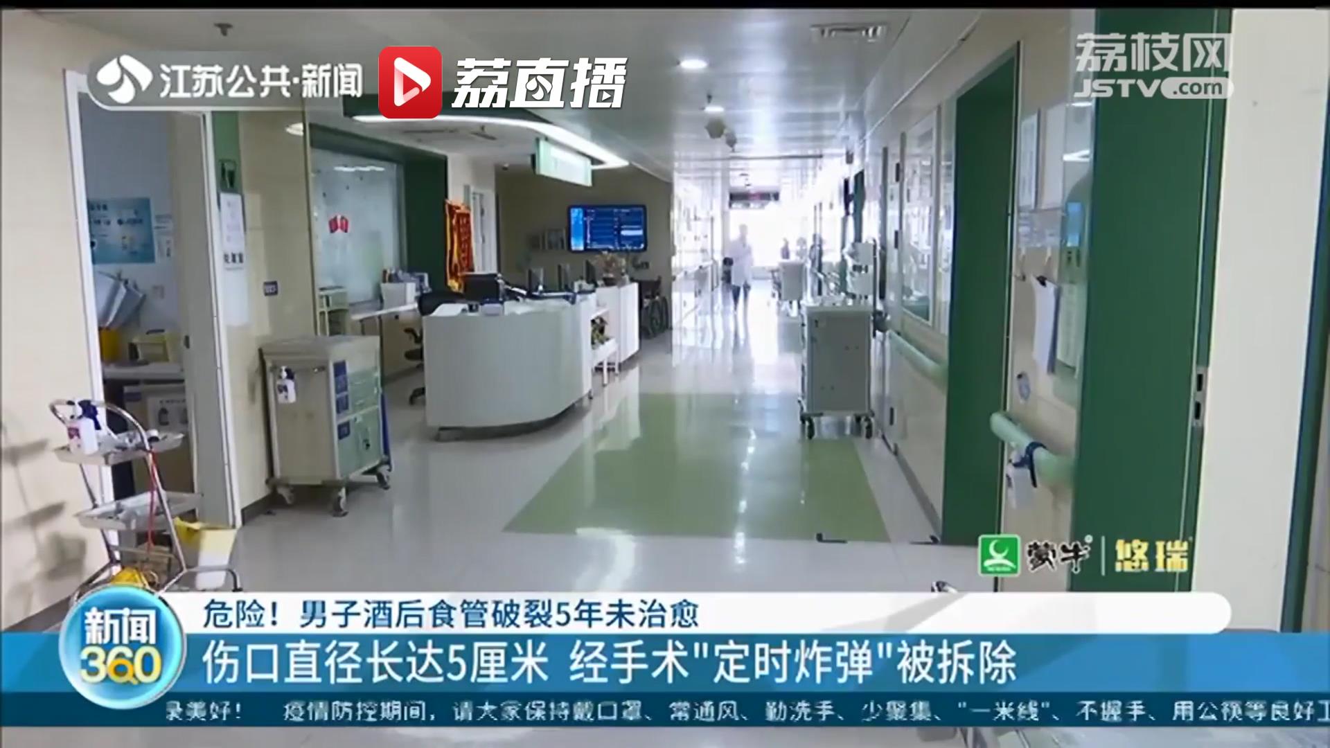 危险！男子酒后食管破裂5年未治愈 犹如&ldquo;定时炸弹&rdquo;